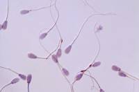 Spermatozoïdes de Taureau x250